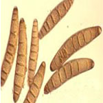 Pătarea cenuşie a frunzelor sau helmintosporioza (Helminthosporium turcicum)